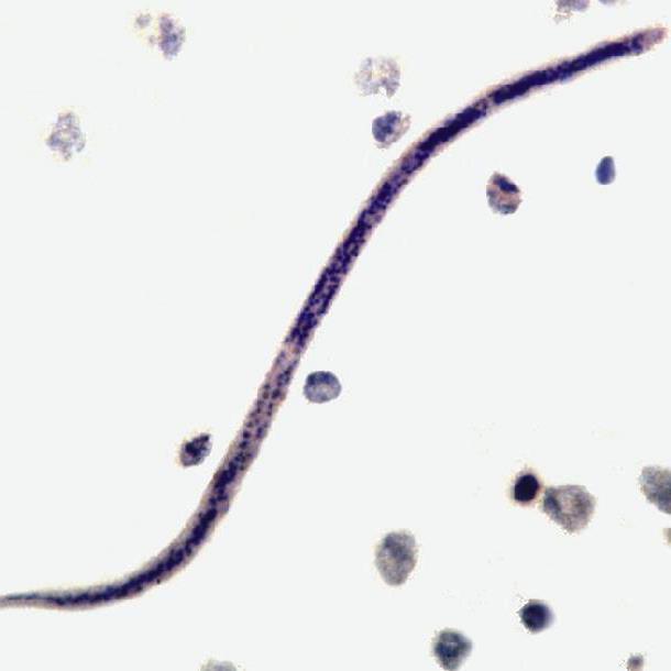 Ký sinh trùng gây bệnh giun chỉ ở vịt