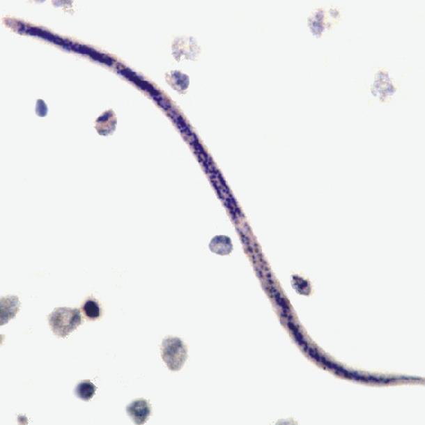 Ký sinh trùng gây bệnh giun chỉ ở vịt